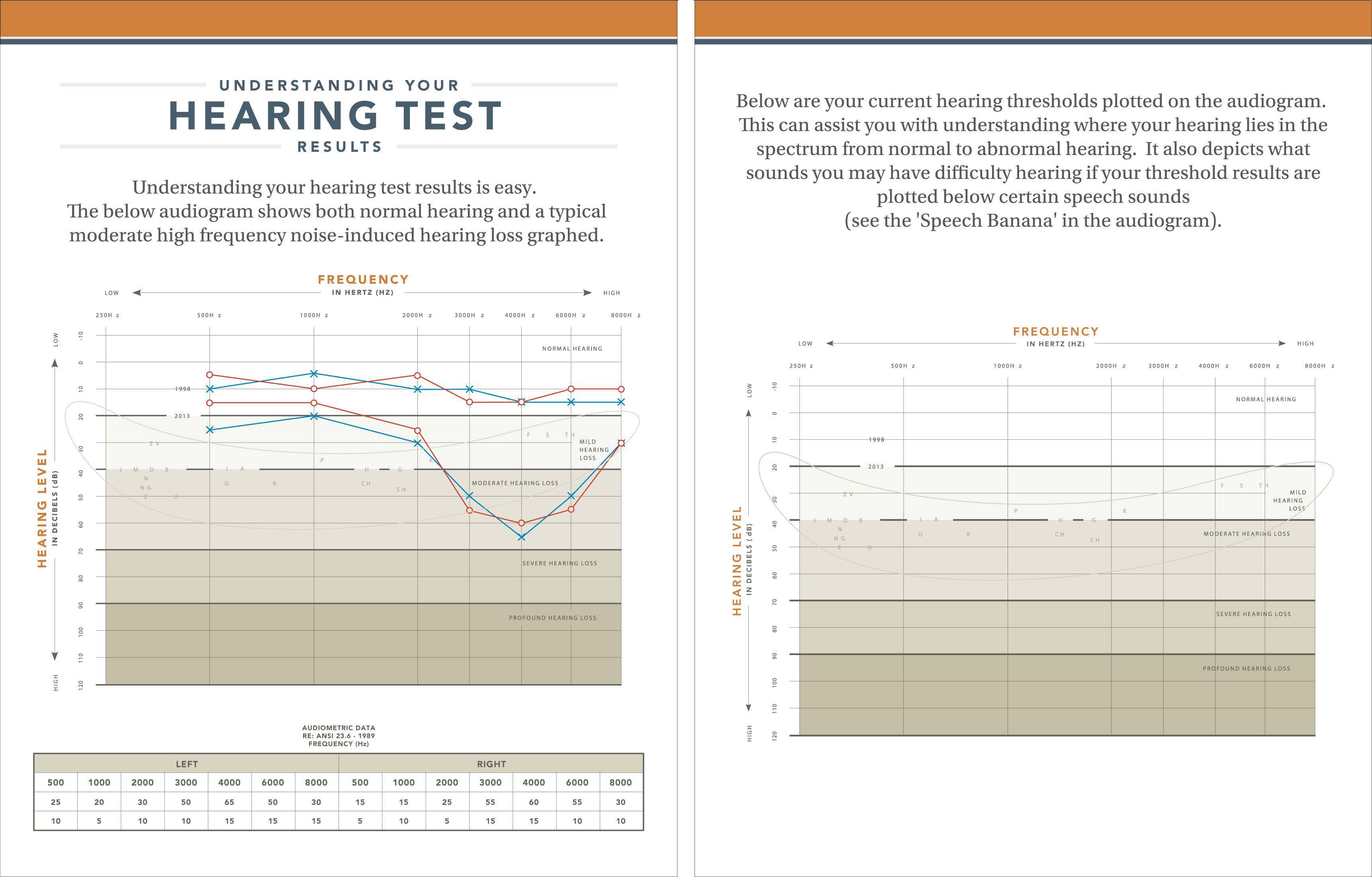 HCE Audiogram – Understanding Your Hearing Test Results 8.5 x 11