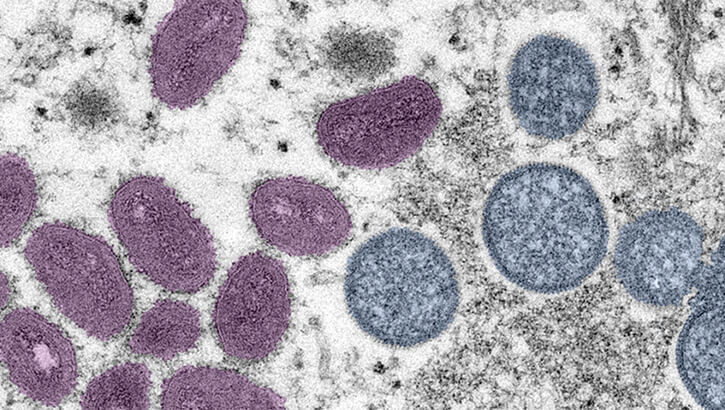Microscopic view of monkeypox virus