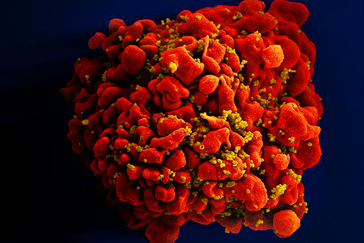 Image of HIV virus.