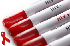 HIV Awareness graphic showing test tubes with HIV + and HIV - labels