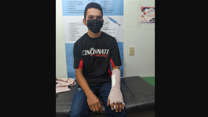 A Honduran man injured in an accident regained motion in his left index finger.